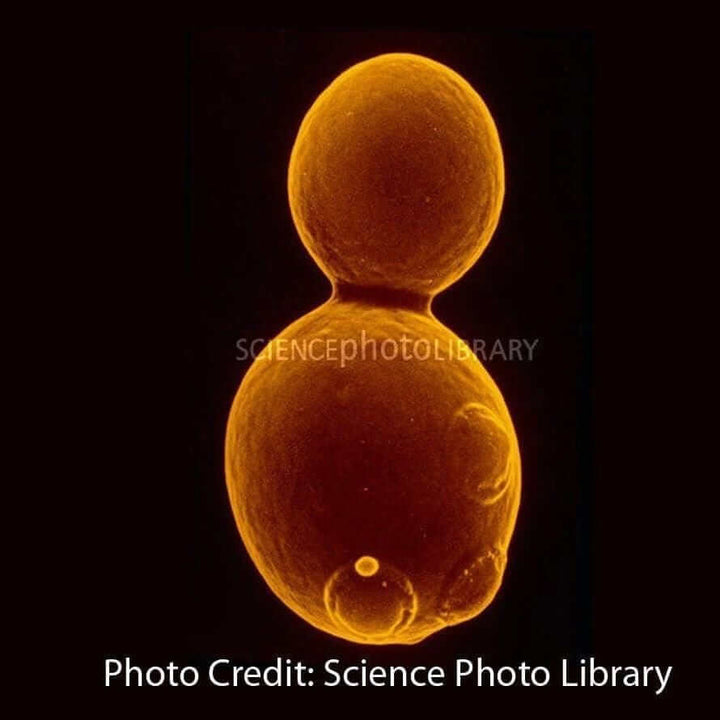 Saccharomyces micrograph science photo library budding yeast [Ontogenie Science Jewelry] 