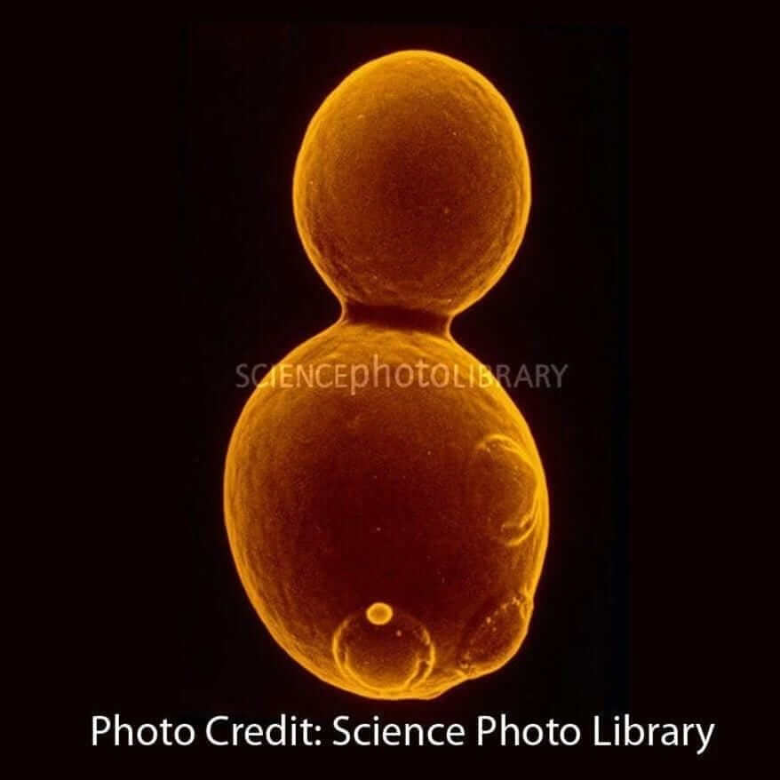 Saccharomyces micrograph science photo library budding yeast [Ontogenie Science Jewelry] 