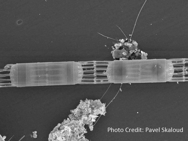 Skeletonema Colonial Diatom micrograph pavel skaloud [Ontogenie Science Jewelry] 