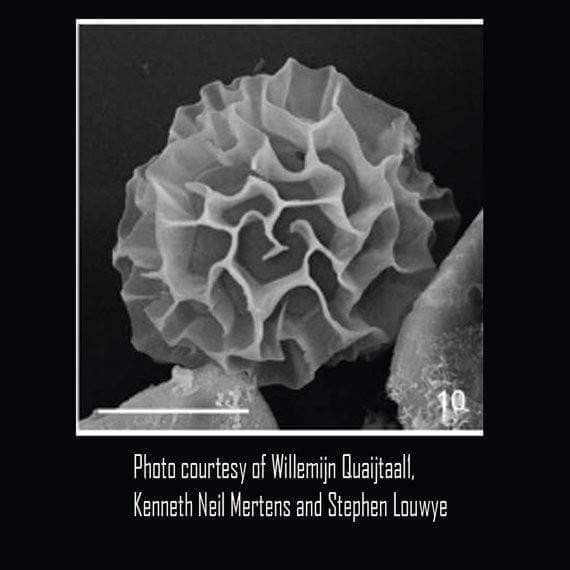 Fossil Acritarch micrograph Willemijn Quaijtaal [Ontogenie Science Jewelry] 