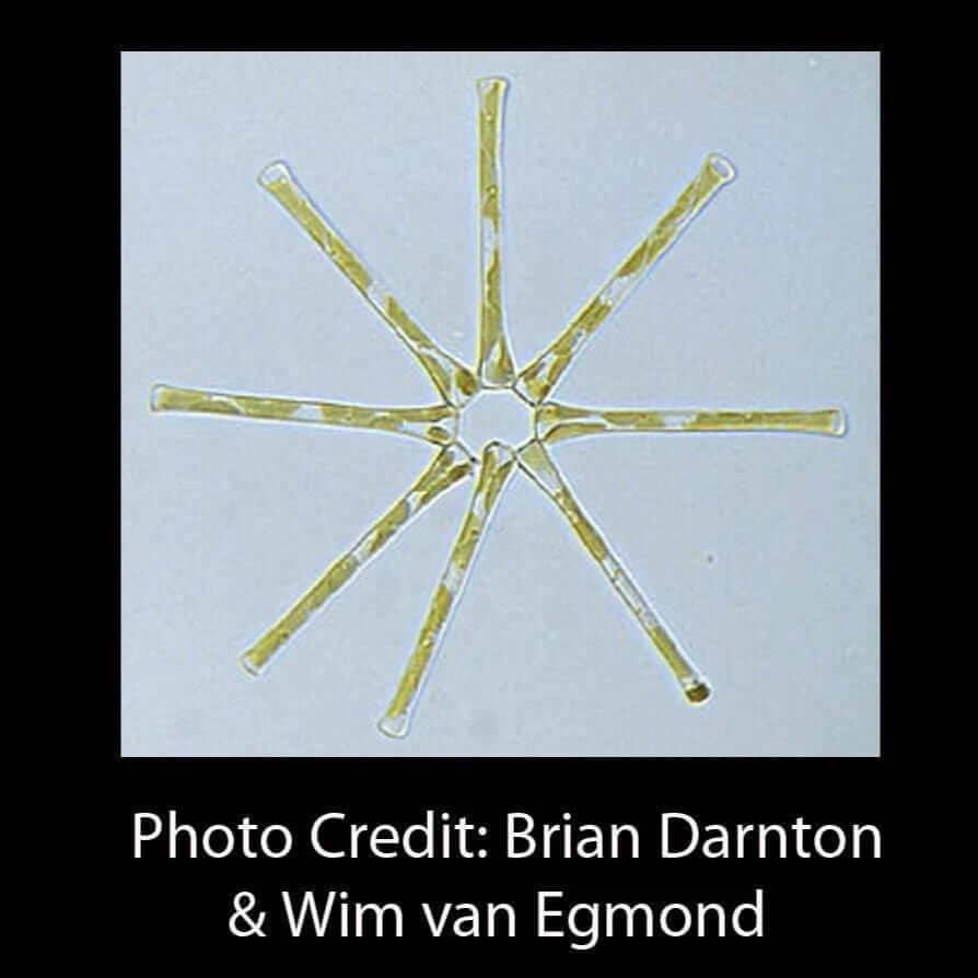 Asterionella Diatom Micrograph Brian Darnton Wim van Egmond [Ontogenie Science Jewelry] 